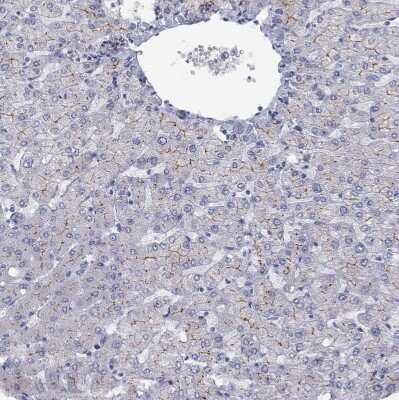 Immunohistochemistry-Paraffin: MDR3/ABCB4 Antibody [NBP2-30876]