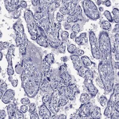 Immunohistochemistry-Paraffin: MDR3/ABCB4 Antibody [NBP2-30876]