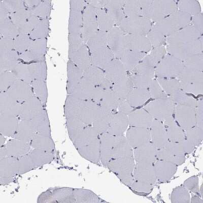 Immunohistochemistry-Paraffin: MDR3/ABCB4 Antibody [NBP2-30876]