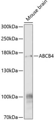 Western Blot: MDR3/ABCB4 AntibodyBSA Free [NBP3-03234]