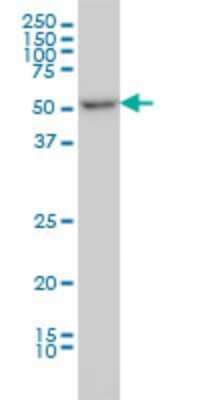 Western Blot: MDS028 Antibody (3D7) [H00055846-M06]