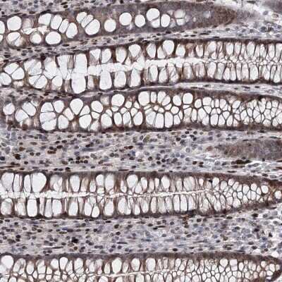 Immunohistochemistry-Paraffin: MDS028 Antibody [NBP2-38424]