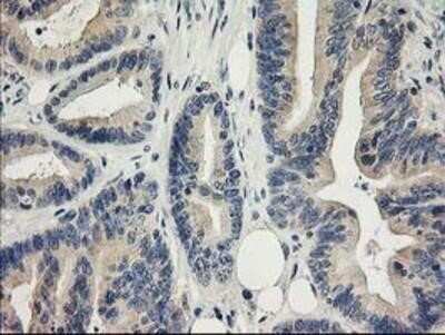 Immunohistochemistry: MDS028 Antibody (OTI3C4) - Azide and BSA Free [NBP2-72614]