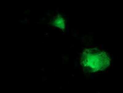 Immunocytochemistry/ Immunofluorescence: MDS028 Antibody (OTI3C4) [NBP2-00860]