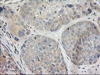 Immunohistochemistry-Paraffin: MDS028 Antibody (OTI3C4) [NBP2-00860]