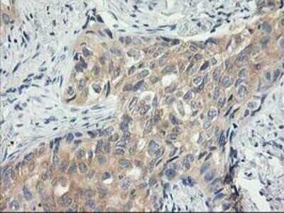 Immunohistochemistry-Paraffin: MDS028 Antibody (OTI3C4) [NBP2-00860]