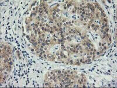 Immunohistochemistry-Paraffin: MDS028 Antibody (OTI3C4) [NBP2-00860]