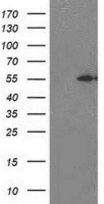 Western Blot: MDS028 Antibody (OTI3C4) [NBP2-00860]