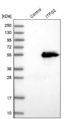 Western Blot: MDS028 Antibody [NBP1-92103]