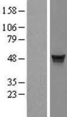 Western Blot: MDS028 Overexpression Lysate [NBL1-12059]