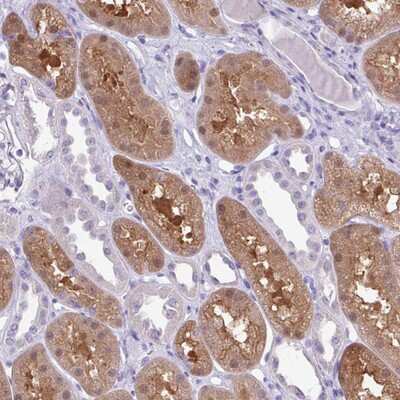 Immunohistochemistry-Paraffin: MDS2 Antibody [NBP2-14774]