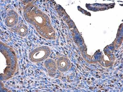 Immunohistochemistry-Paraffin: ME1 Antibody (15611) [NBP2-43669]