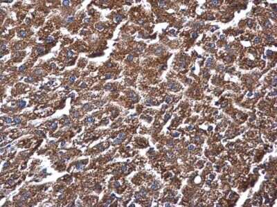 Immunohistochemistry-Paraffin: ME1 Antibody (15611) [NBP2-43669]