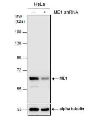 Western Blot: ME1 Antibody (15611) [NBP2-43669]