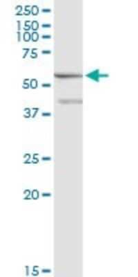 Western Blot: ME1 Antibody (2A2) [H00004199-M01]