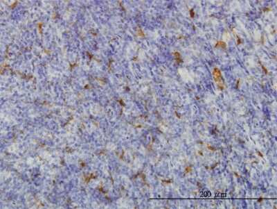 Immunohistochemistry-Paraffin: ME1 Antibody (3H5) [H00004199-M03]