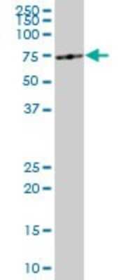 Western Blot: ME1 Antibody (3H5) [H00004199-M03]