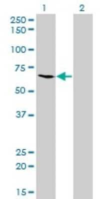 Western Blot: ME1 Antibody (3H5) [H00004199-M03]