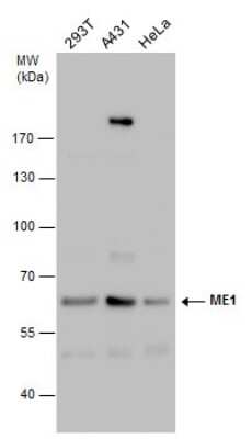 Western Blot: ME1 Antibody (736) [NBP2-43709]