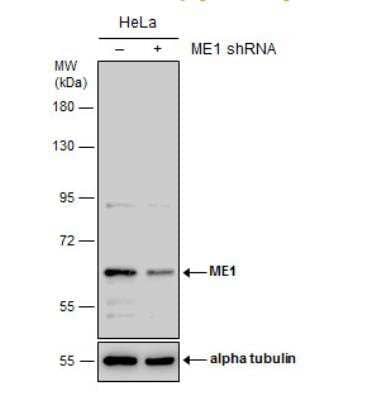 Western Blot: ME1 Antibody (736) [NBP2-43709]