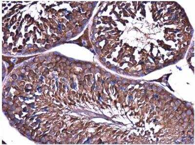 Immunohistochemistry-Paraffin: ME1 Antibody (979) [NBP2-43710]