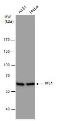 Western Blot: ME1 Antibody (979) [NBP2-43710]