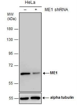 Western Blot: ME1 Antibody (979) [NBP2-43710]