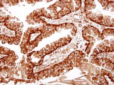 Immunohistochemistry-Paraffin: ME1 Antibody [NBP1-32398]