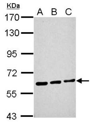 Western Blot: ME1 Antibody [NBP1-32398]