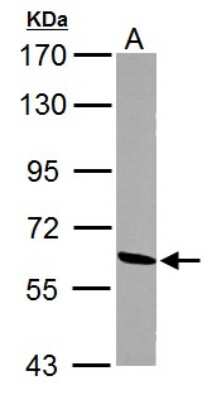 Western Blot: ME1 Antibody [NBP1-32398]