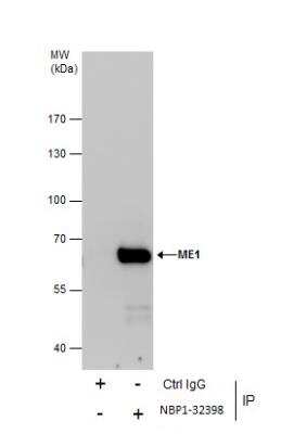 Western Blot: ME1 Antibody [NBP1-32398]