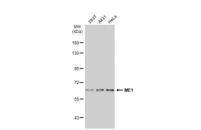 Western Blot: ME1 Antibody [NBP1-32398]