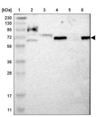 Western Blot: ME1 Antibody [NBP1-86129]