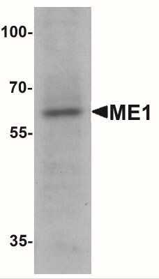 Western Blot: ME1 AntibodyBSA Free [NBP2-41267]