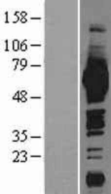 Western Blot: ME1 Overexpression Lysate [NBL1-12973]