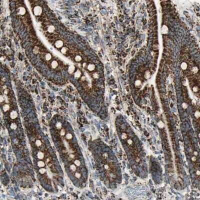 Immunohistochemistry-Paraffin: ME2 Antibody [NBP1-82434]