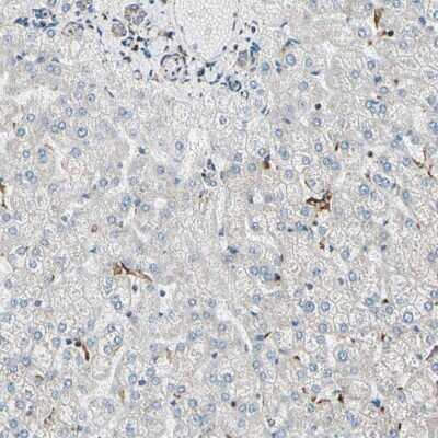Immunohistochemistry-Paraffin: ME2 Antibody [NBP1-82434]