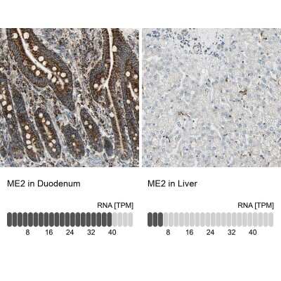 Immunohistochemistry-Paraffin: ME2 Antibody [NBP1-82434]