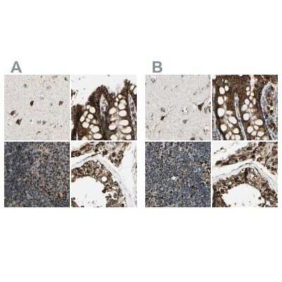 Immunohistochemistry-Paraffin: ME2 Antibody [NBP1-82434]