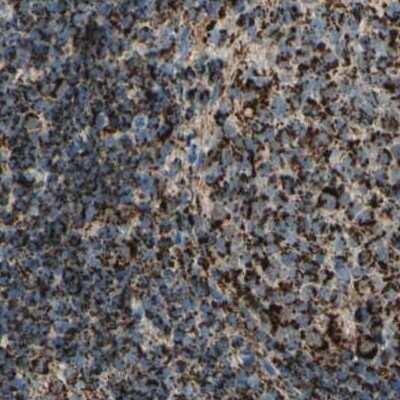 Immunohistochemistry-Paraffin: ME2 Antibody [NBP1-82434]