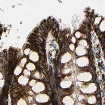 Immunohistochemistry-Paraffin: ME2 Antibody [NBP1-82434]