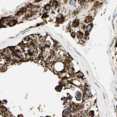 Immunohistochemistry-Paraffin: ME2 Antibody [NBP1-82434]
