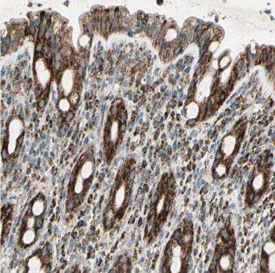 Immunohistochemistry-Paraffin: ME2 Antibody [NBP1-89559]