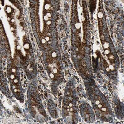 Immunohistochemistry-Paraffin: ME2 Antibody [NBP1-89559]