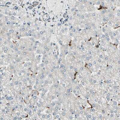 Immunohistochemistry-Paraffin: ME2 Antibody [NBP1-89559]
