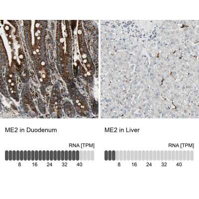 Immunohistochemistry-Paraffin: ME2 Antibody [NBP1-89559]