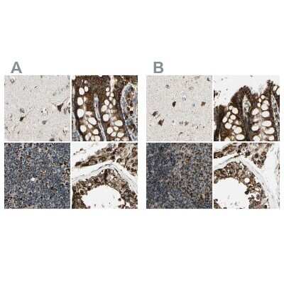 Immunohistochemistry-Paraffin: ME2 Antibody [NBP1-89559]