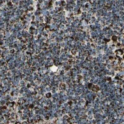 Immunohistochemistry-Paraffin: ME2 Antibody [NBP1-89559]