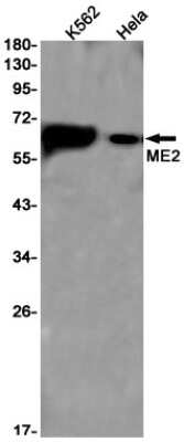 Western Blot: ME2 Antibody (S04-7I2) [NBP3-15058]