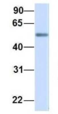 Western Blot: ME2 Antibody [NBP1-54765]